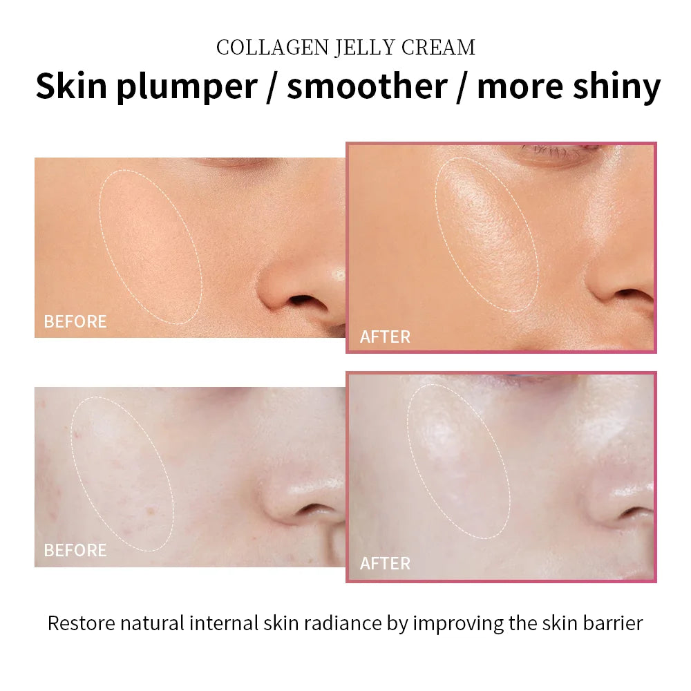Anti Aging Collagen Face Cream 100ml Niacinamide Moisturizer Hydrating Gel For Tightening Soothing Firmness Skincare - ShoreCo.Shop