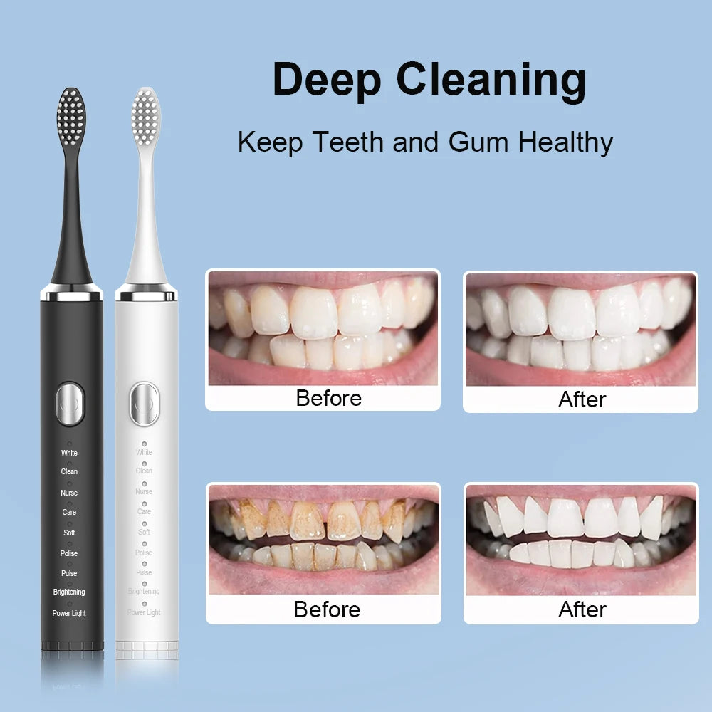 Electric Toothbrush Sonic Electric Toothbrush For Teeth Brushes Vibration Dental Tooth Cleaner USB Rechargeable Tooth Brush Case - ShoreCo.Shop